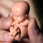 Ilustrssi Aborsi